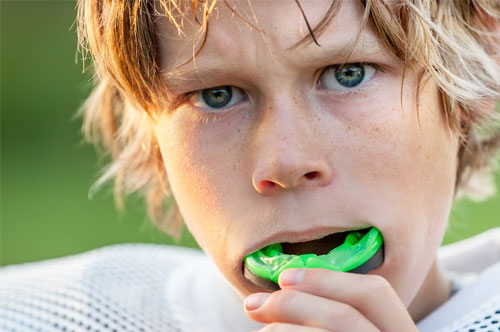 Image Text: mouthguards_1